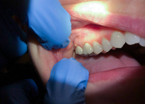 Best Walk-In Emergency Dental Services in Brookshire, TX