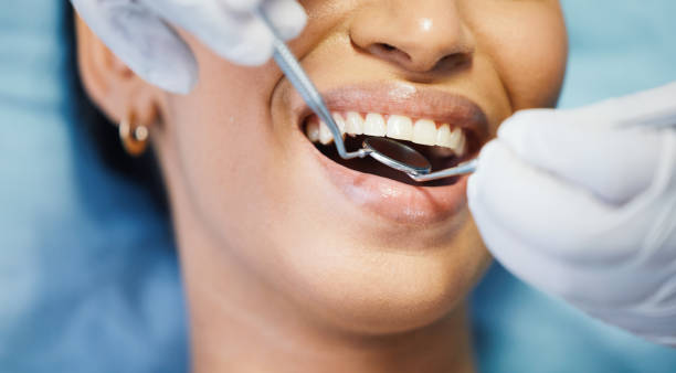 Best Knocked-Out Tooth (Avulsed Tooth) Treatment in Brookshire, TX